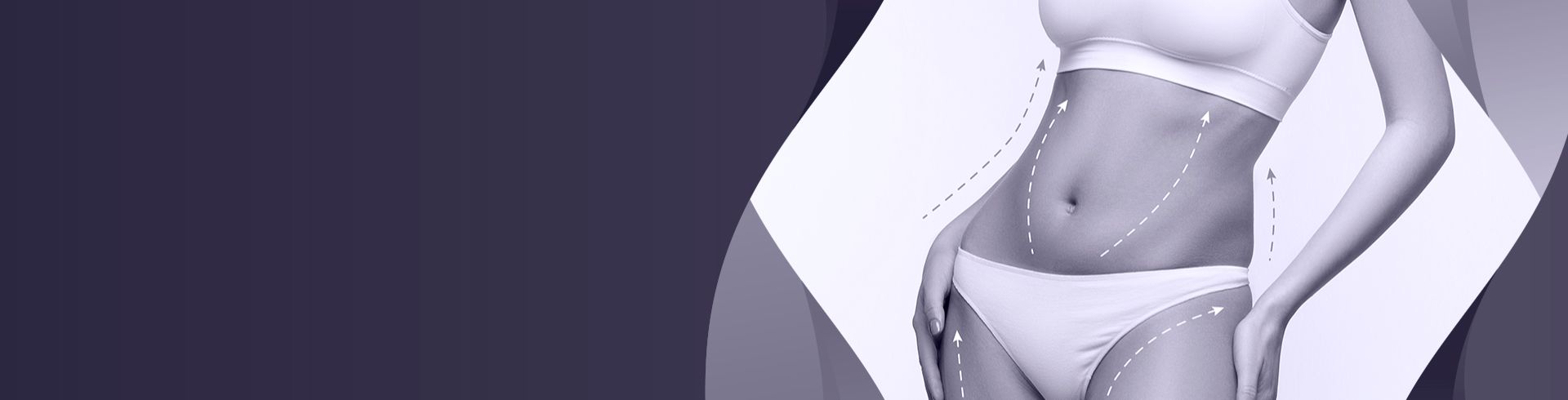 Montagem de fundo com uma foto que representa a cirurgia de Lipoaspiração